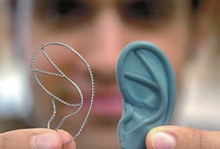 上海耳朵整形手术一般多少钱