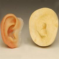 耳朵畸形矫正术有五大优势