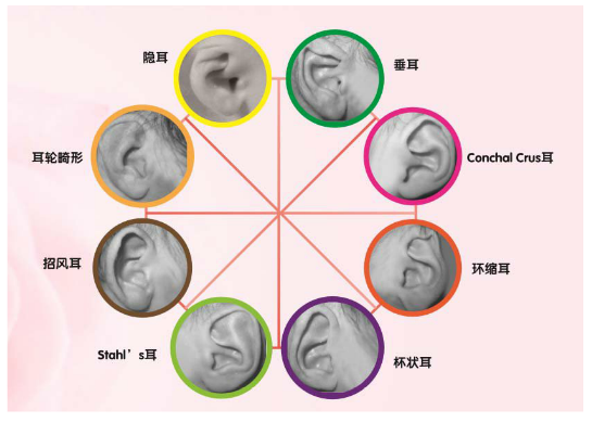 耳朵整形去哪里好